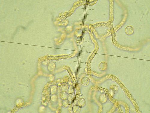 A globosa blatères et spores