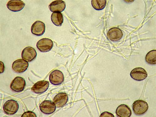 Phys leuco spores