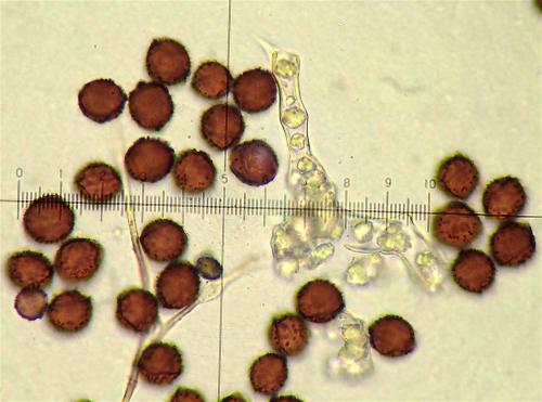 BW3214-Did-trachy-spores-cap4