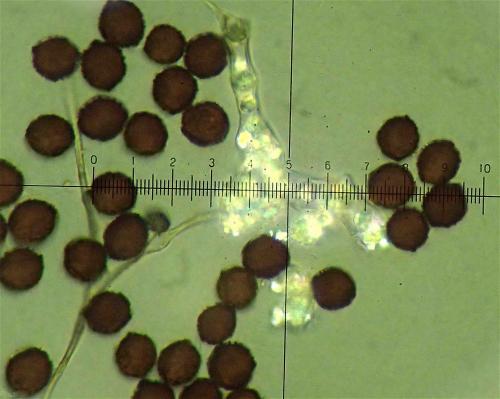BW3214-Did-trachy-spores-cap5