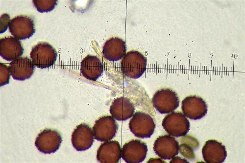 BW3214-Did-trachy-spores1