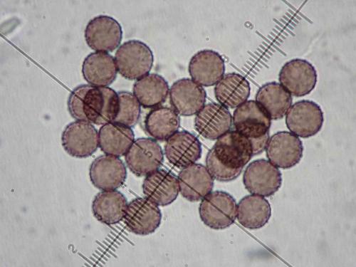 BW4143-P-leucopus4-Spores