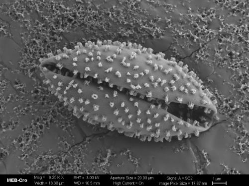 BW4626-HEMlut-MEB-spore