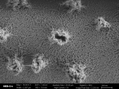 BW4626-HEMlut-MEB-spore3