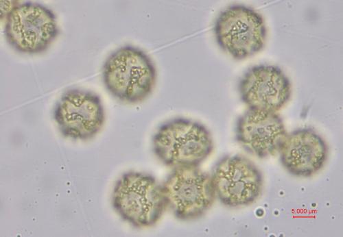 BW4187-CALcor-spores2