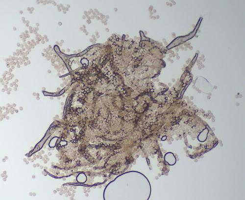 4698-Lycogala-roseo-4-cap1