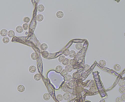 4698-Lycogala-roseo-4-cap2