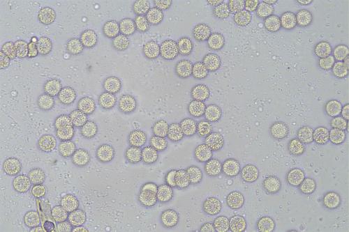 4698-Lycogala-roseo-5-spores1