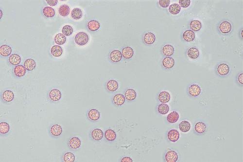4698-Lycogala-roseo-5-spores2