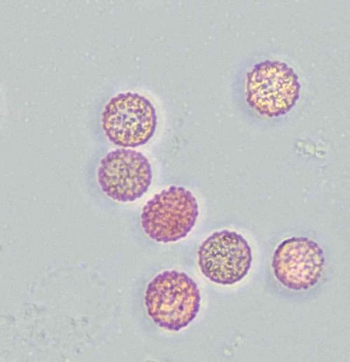 4698-Lycogala-roseo-5-spores3