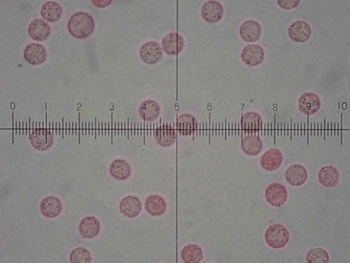 4698-Lycogala-roseo-5-spores4