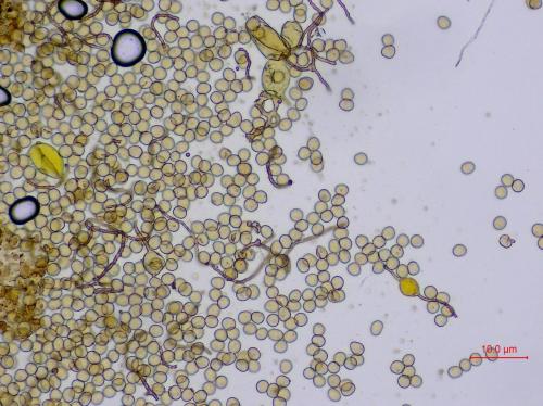 KW0895-3-cap-et-vésiculesx200