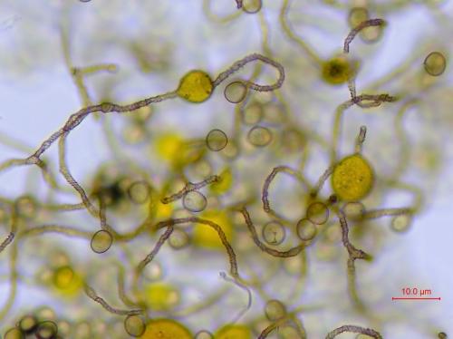 KW0895-4-vésiculesx400