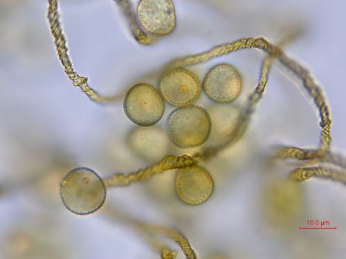 KW0895-5-sporesx1000