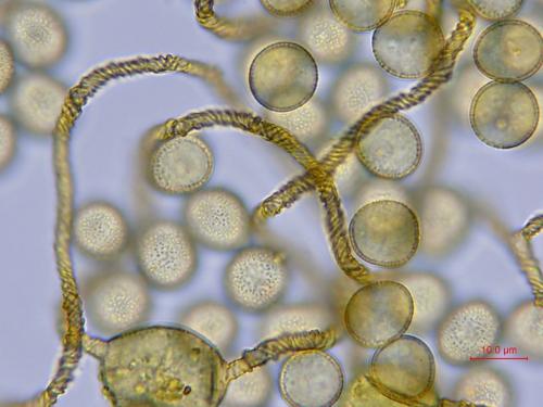 KW0895-6-sporesx1000