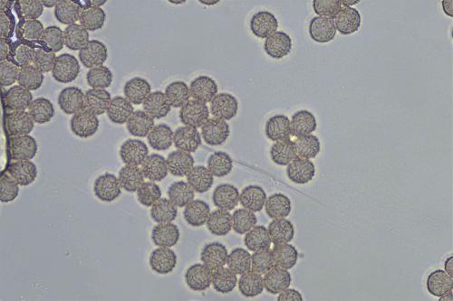 S-fuscoides6-spores1