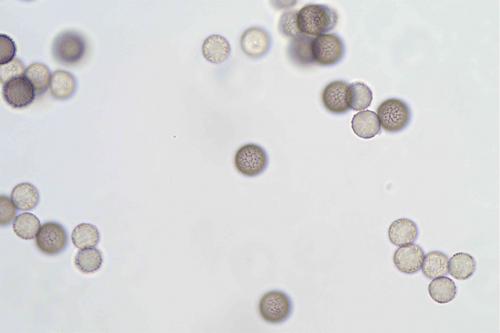 S-fuscoides8-spores-et-Sfusca-spores